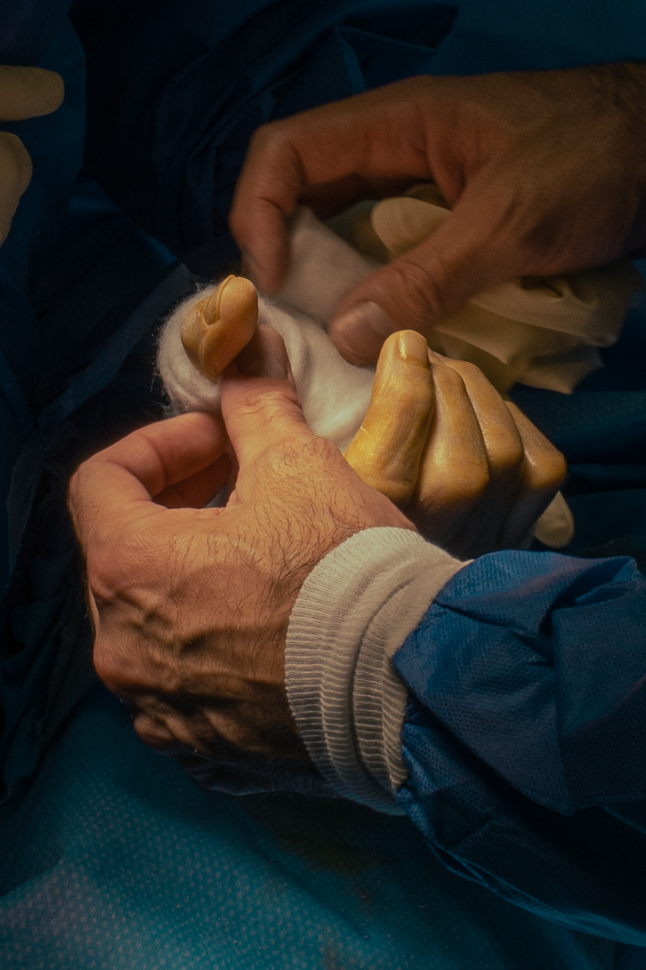 3 months in a surgery room.